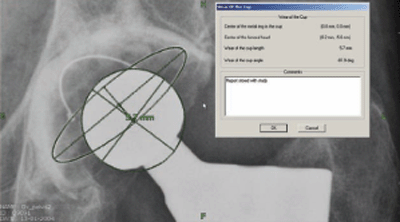 dicom-structured measurement report