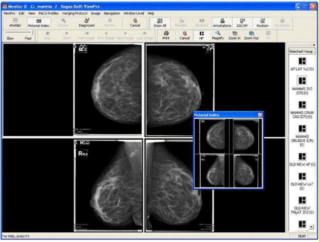 rogan online vpx viewer